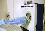 CT-SCAN